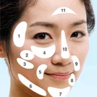 Xóa nếp nhăn rãnh mũi má bằng chất làm đầy